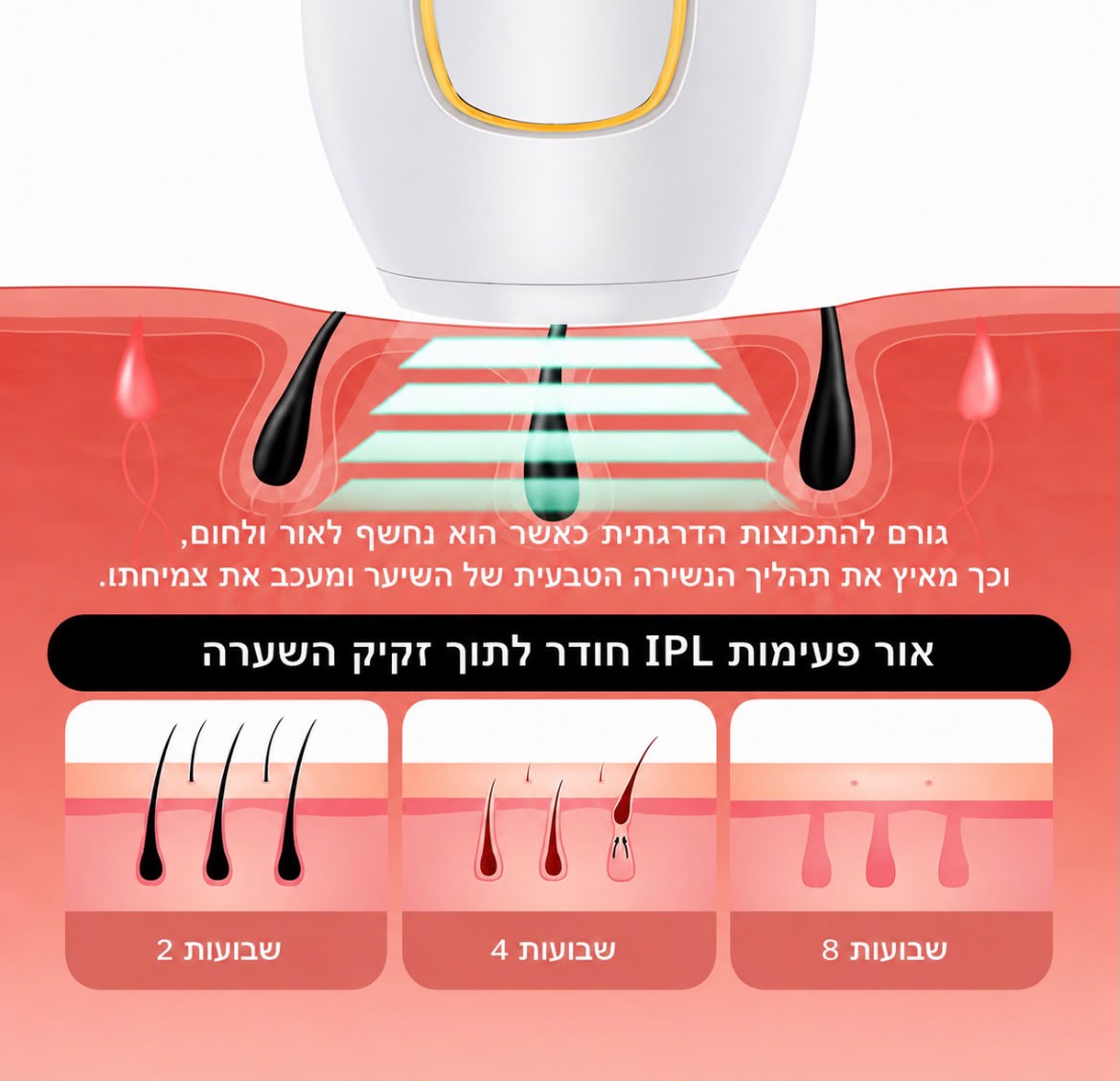 לייזר ביתי להסרת שיער לצמיתות IPL